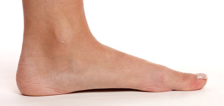 flat feet