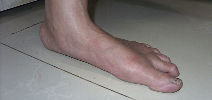 Vionic Sandals for Flat feet