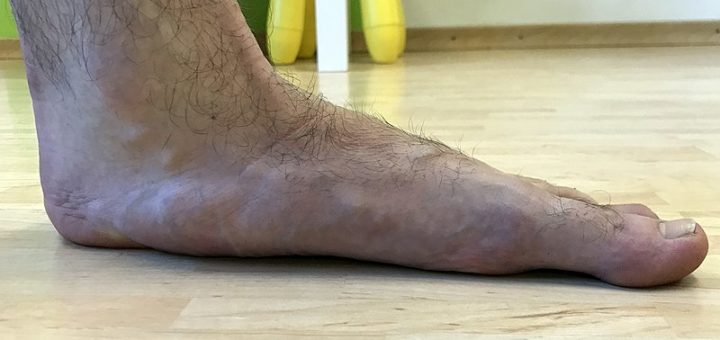 Slides for Flat Feet