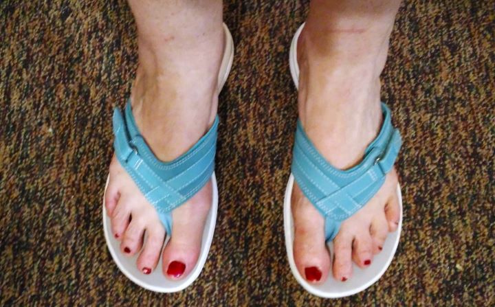Sandals for Sesamoiditis
