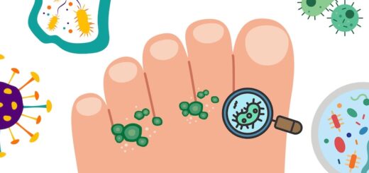 Hybrid Flip-Flops for Athlete's Foot Featured Image